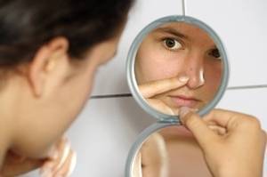 acne juveline et homeopathie